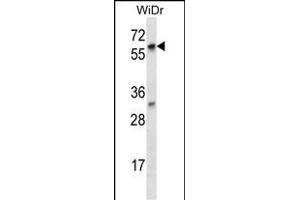LARP7 Antibody (C-term) (ABIN656914 and ABIN2846110) western blot analysis in WiDr cell line lysates (35 μg/lane).