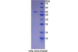 Image no. 1 for NUAK Family, SNF1-Like Kinase, 1 (NUAK1) (AA 421-658) protein (His tag) (ABIN6239966) (NUAK1 Protein (AA 421-658) (His tag))