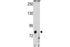 Western Blotting (WB) image for anti-Zinc Finger, Matrin-Type 1 (ZMAT1) antibody (ABIN3004468) (ZMAT1 Antikörper)