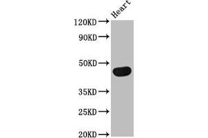 Western Blot Positive WB detected in: Rat heart tissue All lanes: TRDMT1 antibody at 4 μg/mL Secondary Goat polyclonal to rabbit IgG at 1/50000 dilution Predicted band size: 45, 42, 40, 7, 8, 13 kDa Observed band size: 45 kDa (Dnmt2 Antikörper  (AA 170-269))