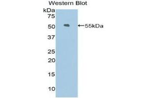 Western Blotting (WB) image for anti-Kinesin Family Member 5A (KIF5A) (AA 823-1027) antibody (ABIN1859531) (KIF5A Antikörper  (AA 823-1027))