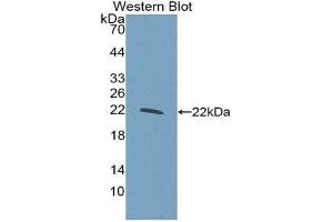 Western Blotting (WB) image for anti-Glucokinase (Hexokinase 4) Regulator (GCKR) (AA 320-499) antibody (ABIN3206778) (GCKR Antikörper  (AA 320-499))