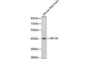 Western blot analysis of extracts of Mouse fetal brain using NPY1R Polyclonal Antibody. (NPY1R Antikörper)