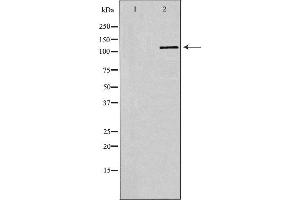 Western blot analysis of extracts of Jurkat, using SELPLG antibody. (SELPLG Antikörper  (N-Term))