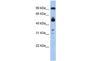CCDC144B antibody used at 1 ug/ml to detect target protein. (CCDC144B Antikörper  (Middle Region))
