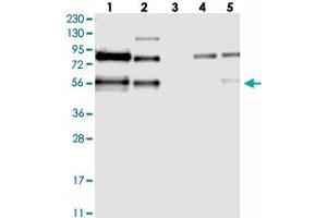 Western blot analysis of Lane 1: RT-4, Lane 2: U-251 MG, Lane 3: Human Plasma, Lane 4: Liver, Lane 5: Tonsil with TJAP1 polyclonal antibody . (TJAP1 Antikörper)