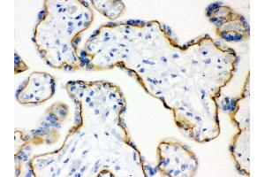 Immunohistochemistry (Paraffin-embedded Sections) (IHC (p)) image for anti-Cadherin 1, Type 1, E-Cadherin (Epithelial) (CDH1) (AA 286-703) antibody (ABIN3043808) (E-cadherin Antikörper  (AA 286-703))