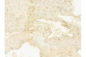 ABIN6260366 and ABIN6279322 at 1/100 staining human testicular cancer by IHC-P.