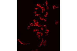 ABIN6268951 staining Hela by IF/ICC. (CD247 Antikörper  (C-Term))