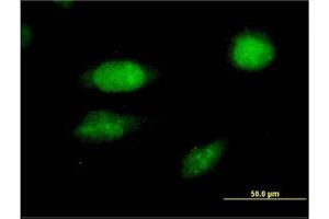 Image no. 2 for anti-Forkhead Box C2 (MFH-1, Mesenchyme Forkhead 1) (FOXC2) (AA 421-502) antibody (ABIN466014) (FOXC2 Antikörper  (AA 421-502))