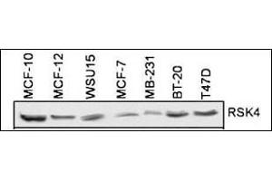 Western Blotting (WB) image for anti-Ribosomal Protein S6 Kinase, 90kDa, Polypeptide 6 (RPS6KA6) (AA 15-45), (N-Term) antibody (ABIN1882127)