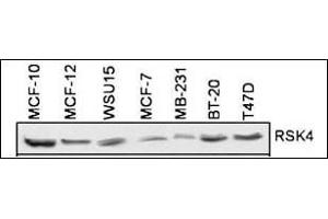 RSK4 Antibody (N-term) (ABIN1882127 and ABIN2842047) is used to detect RSK4 in 7 different cell lines. (RPS6KA6 Antikörper  (N-Term))