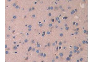 DAB staining on IHC-P; Samples: Mouse Cerebrum Tissue (LAMB2 Antikörper  (AA 1498-1716))