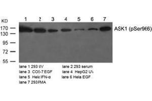 Image no. 2 for anti-Mitogen-Activated Protein Kinase Kinase Kinase 5 (MAP3K5) (pSer966) antibody (ABIN196914) (ASK1 Antikörper  (pSer966))