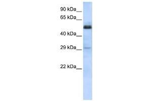 Western Blotting (WB) image for anti-Sex Comb On Midleg-Like 1 (SCML1) antibody (ABIN2458173) (SCML1 Antikörper)
