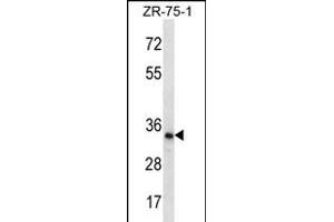 TLCD2 Antibody (C-term) (ABIN656296 and ABIN2845603) western blot analysis in ZR-75-1 cell line lysates (35 μg/lane).