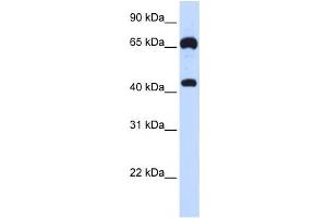 Western Blotting (WB) image for anti-Guanylate Cyclase 1, Soluble, beta 3 (GUCY1B3) antibody (ABIN2458977) (GUCY1B3 Antikörper)