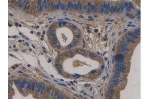DAB staining on IHC-P; Samples: Mouse Uterus Tissue) (Fibulin 1 Antikörper  (AA 399-578))
