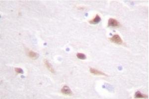 Image no. 2 for anti-Casein Kinase 2, beta (CSNK2B) antibody (ABIN272014) (CSNK2B Antikörper)