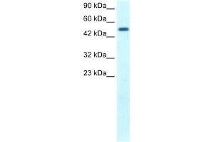 WB Suggested Anti-FLJ14768 Antibody Titration: 1. (FIZ1 Antikörper  (C-Term))