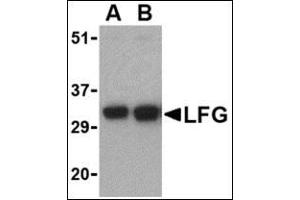 Western blot analysis of LFG in EL4 cell lysate with this product at (A) 0. (FAIM2 Antikörper  (N-Term))