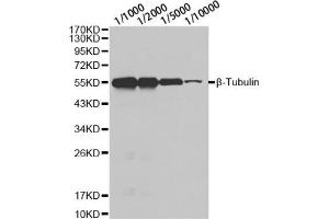 Western blot analysis of HeLa cell using β-tubulin antibody at different dilution. (TUBB Antikörper)