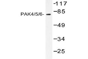 Image no. 1 for anti-P21-Activated Kinase 4 (PAK4) antibody (ABIN317882) (PAK4 Antikörper)