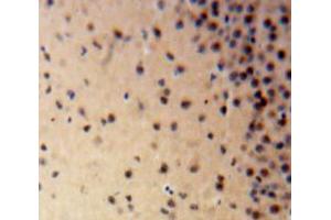 Used in DAB staining on fromalin fixed paraffin-embedded Brain tissue (LIG1 Antikörper  (AA 568-875))