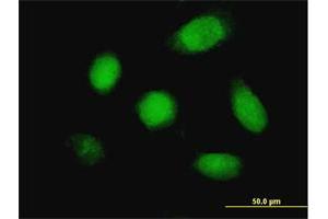 Immunofluorescence of monoclonal antibody to DUSP5 on HeLa cell. (DUSP5 Antikörper  (AA 286-384))