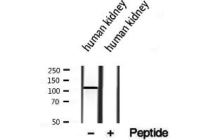 Western blot analysis of extracts from human kidney, using MKS3 antibody. (TMEM67 Antikörper  (Internal Region))