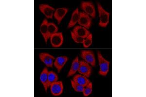 Confocal immunofluorescence analysis of HeLa cells using RPL36 Polyclonal Antibody (ABIN6129105, ABIN6147141, ABIN6147142 and ABIN6223749) at dilution of 1:200. (RPL36 Antikörper  (AA 1-105))