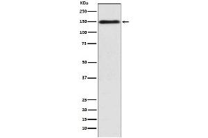 Western blot analysis of COL11A1 expression in K562 cell lysate.