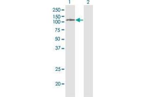 Western Blotting (WB) image for anti-Phospholipase D2 (PLD2) (AA 834-933) antibody (ABIN562269)