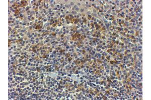 Immunohistochemistry (IHC) image for anti-Myeloid Differentiation Primary Response Gene (88) (MYD88) (Internal Region) antibody (ABIN185362)