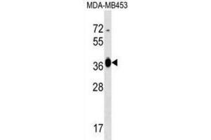 Western Blotting (WB) image for anti-Glucose-Fructose Oxidoreductase Domain Containing 2 (GFOD2) antibody (ABIN2999227) (GFOD2 Antikörper)