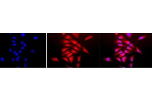 Immunocytochemistry/Immunofluorescence analysis using Rabbit Anti-SOD (Cu/Zn) Polyclonal Antibody (ABIN361651 and ABIN361652). (SOD1 Antikörper)