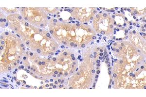 Detection of CASP8 in Human Kidney Tissue using Polyclonal Antibody to Caspase 8 (CASP8) (Caspase 8 Antikörper  (AA 217-384))