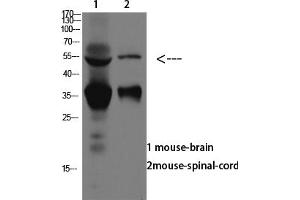 Western blot analysis of SW480 lysate, antibody was diluted at 1:1000.