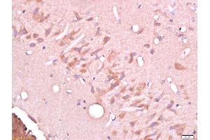 Paraformaldehyde-fixed, paraffin embedded rat brain tissue, Antigen retrieval by boiling in sodium citrate buffer(pH6) for 15min, Block endogenous peroxidase by 3% hydrogen peroxide for 30 minutes, Blocking buffer (normal goat serum) at 37°C for 20min, Antibody incubation with Rabbit Anti-CELSR3/Flamingo homolog 1 Polyclonal Antibody, Unconjugated  at 1:500 overnight at 4°C, followed by a conjugated secondary and DAB staining (CELSR3 Antikörper  (AA 1601-1700))