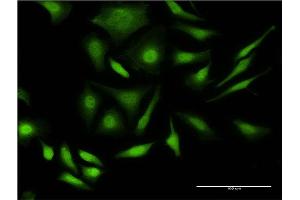Immunofluorescence of monoclonal antibody to PRPF4B on HeLa cell.