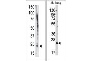 Image no. 1 for anti-BH3 Interacting Domain Death Agonist (BID) (BH3 Domain) antibody (ABIN356816) (BID Antikörper  (BH3 Domain))