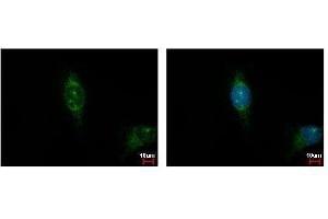 ICC/IF Image Casein Kinase 1 alpha 1L antibody detects CSNK1A1L protein at cytoplasm by immunofluorescent analysis. (CSNK1A1L Antikörper)