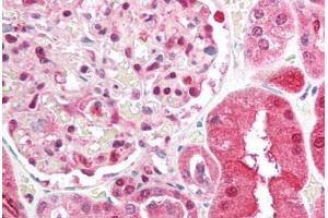 Human Kidney (formalin-fixed, paraffin-embedded) stained with BRCC3 antibody ABIN213911 at 5 ug/ml followed by biotinylated goat anti-rabbit IgG secondary antibody ABIN481713, alkaline phosphatase-streptavidin and chromogen. (BRCC3 Antikörper  (N-Term))