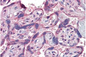 ABIN335143 (5µg/ml) staining of paraffin embedded Human Placenta. (IFNAR2 Antikörper  (Internal Region))