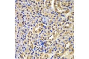 Immunohistochemistry of paraffin-embedded mouse kidney using NFKBIA antibody (ABIN4904526) at dilution of 1:100 (40x lens).