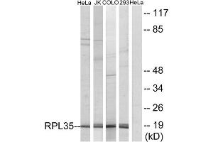 Western blot analysis of extracts from HeLa cells, Jurkat cells, COLO cells and 293 cells, using RPL35 antibody. (RPL35 Antikörper  (Internal Region))