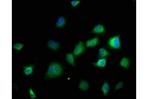 Immunofluorescence staining of SH-SY5Y cells with ABIN7150001 at 1:166, counter-stained with DAPI. (DPH5 Antikörper  (AA 138-235))