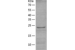 Western Blotting (WB) image for BEN Domain Containing 6 (BEND6) (AA 1-279) protein (His tag) (ABIN7121993)