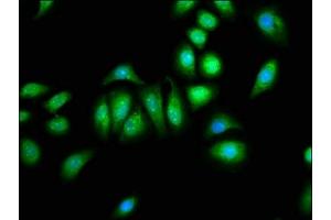 Immunofluorescence staining of A549 cells with ABIN7146392 at 1:133, counter-stained with DAPI. (PNPLA8 Antikörper  (AA 158-345))