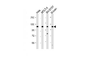All lanes : Anti-KI Antibody (C-term) at 1:2000 dilution Lane 1: Hela whole cell lysate Lane 2: MOLT-4 whole cell lysate Lane 3: SH-SY5Y whole cell lysate Lane 4: Mouse brain lysate Lysates/proteins at 20 μg per lane. (ARHGAP39 Antikörper  (C-Term))
